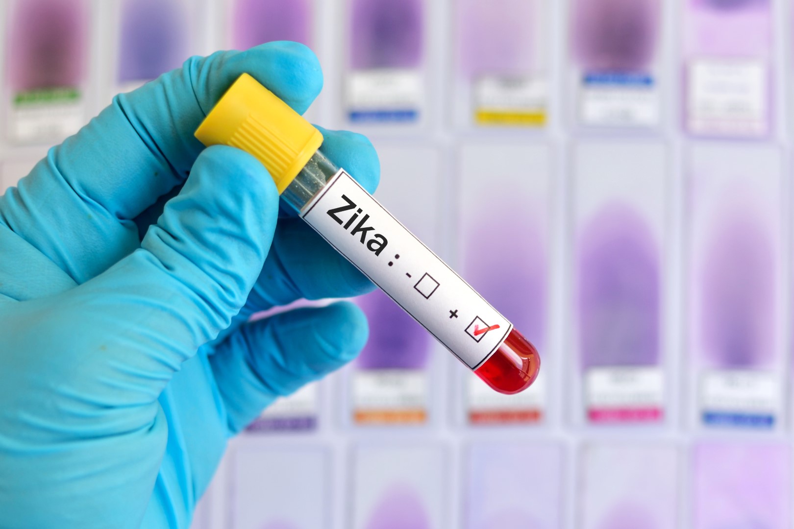 zika test (Large)