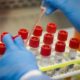 In this Wednesday, March 11, 2020 file photo, a technician prepares COVID-19 coronavirus patient samples for testing at a laboratory in New York's Long Island. Wide scale testing is a critical part of tracking and containing infectious diseases. But the U.S. effort has been plagued by a series of missteps, including accuracy problems with the test kits the CDC sent to other labs and bureaucratic hurdles that slowed the entrance of large, private sector labs. (AP Photo/John Minchillo)