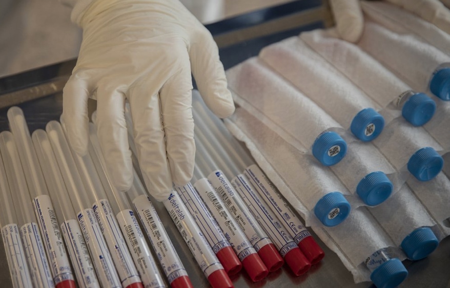 Coronavirus detection test kits
