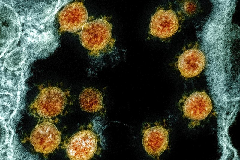 coronavirus.jpeg