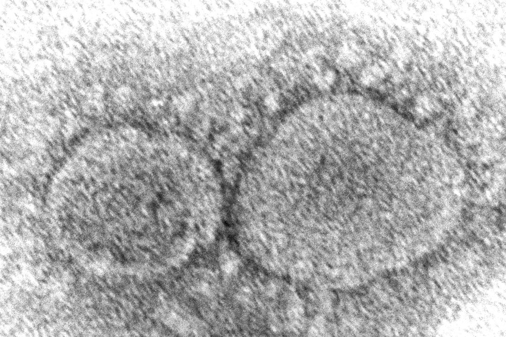 COVID-19 coronavirus