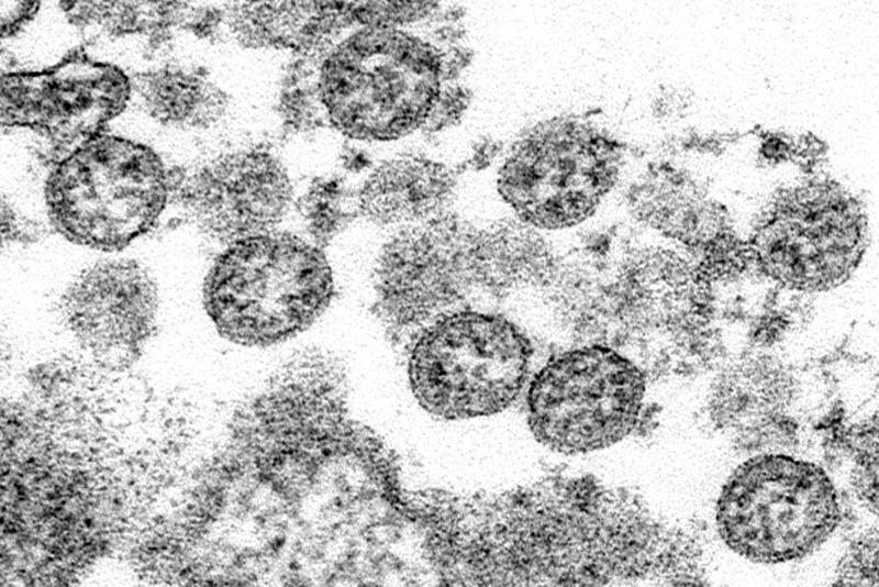 coronavirus COVID-19